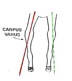 Angular leg deformity  - carpus varus
